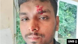 রবিবার (২৪ সেপ্টেম্বর) বেলা সাড়ে ১১টার দিকে ক্যাম্পাসের দ্বিতীয় কলা ও মানববিদ্যা অনুষদের সামনে দৈনিক প্রথম আলো’র চট্টগ্রাম বিশ্ববিদ্যালয় প্রতিনিধি মোশারফ শাহ কে মারধর করা হয়। 