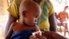 Le bras d'un enfant est mesuré dans un centre mis en place par le PAM et Action contre la Faim, dans le village de Beraketa, à l'extrême sud de Madagascar. 12 novembre 2020.